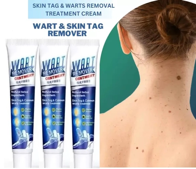 Wart Remover Cream (100 g, Pack of 3)