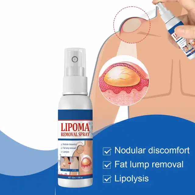 Feminela Lipoma Remover Spray (60 ml)