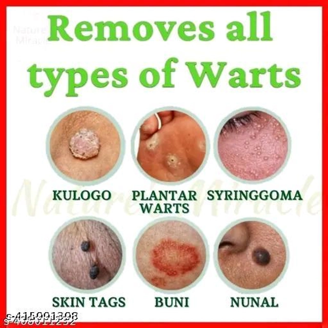 Wart Removal Ointment (50 g)