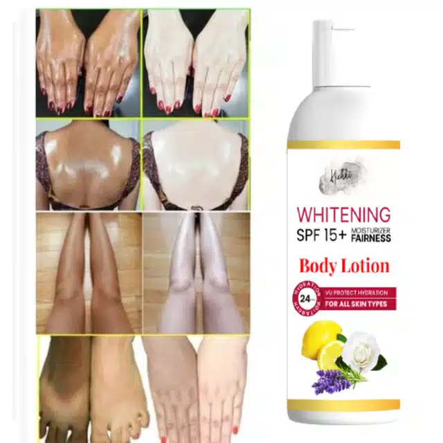 SPF 15+ Skin Whitening Body Lotion (100 g)