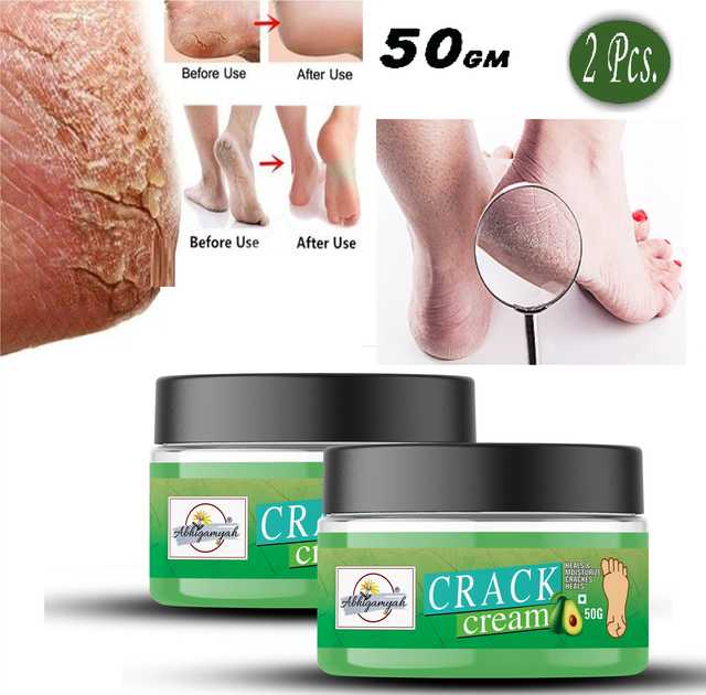 Foot Care Cream For Rough, Dry And Cracked Heel For Healing & Softening (50 g, Pack Of 2) (Ab-00487)