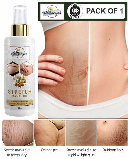 Natural Stretch Marks Removal For Breast, Hip & Legs (100 ml) (Ab-00987)