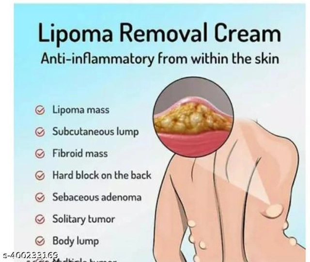 Lipoma Removal Cream (30 g)