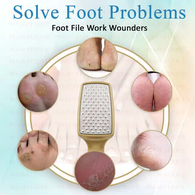 Majestique Professionally Designed Callus Remover Foot Scrubber (Pack of 1, Gold) (BB-27)