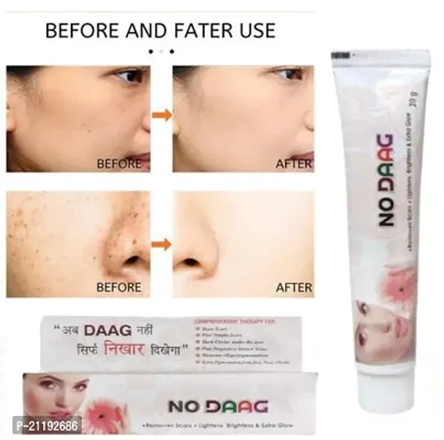 No Daag Cream (20 g, Pack of 2)