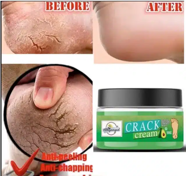 Foot Care Cream For Rough, Dry And Cracked Heel For Healing & Softening (50 g) (Ab-00500)