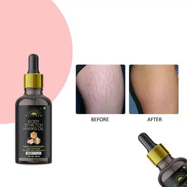 Desi Crew Stretch Mark Removal Oil (30 ml)