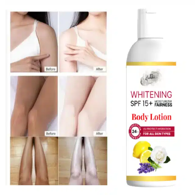 SPF 15+ Skin Whitening Body Lotion (100 g)