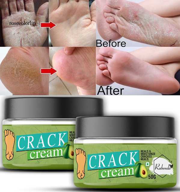 Rabenda Foot Care Cream for Rough, Dry & Cracked Heels (Pack of 2, 50 g) (AF-228)