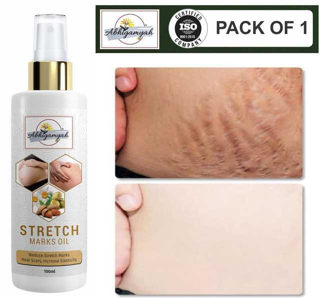 Abhigamyah Present Repair Stretch Marks Removal Natural Heal Pregnancy Breast, Hip, Legs, Mark Oil (100 ml, Pack Of 1) (A-985)