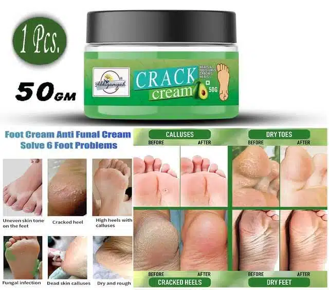 Foot Care Cream For Rough, Dry And Cracked Heel For Healing & Softening (50 g) (Ab-00500)