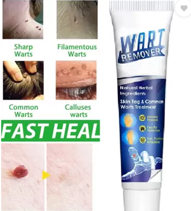 Atemporal Warts Remover Cream (100 g)