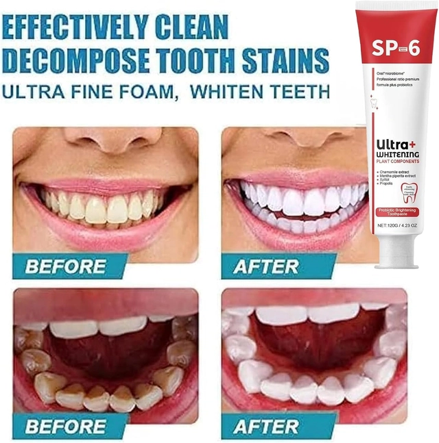 SP6 Teeth Treatment Toothpaste (120 g)