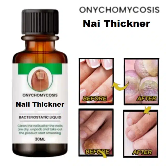 Antibacterial Treatment Essential Oil for Nails (30 ml)