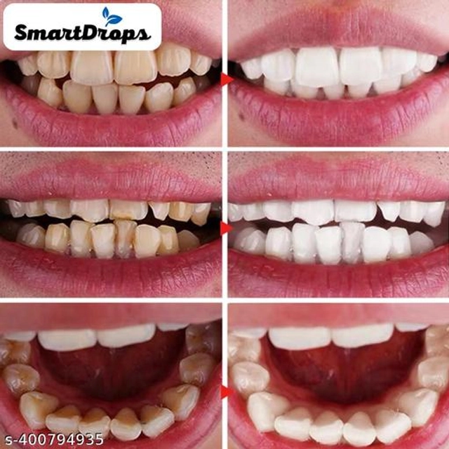 Smartdrops Teeth Whitening Foam (60 ml)