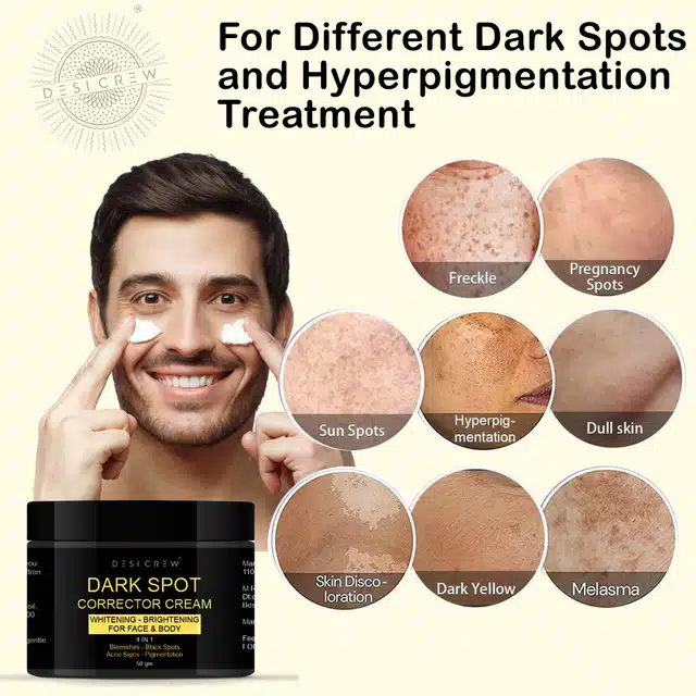 Desi Crew Dark Spot Remover Cream (50 g)