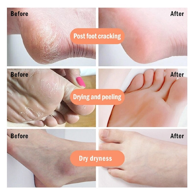 Kuraiy Cosmetic Foot Care Cream (50 g)