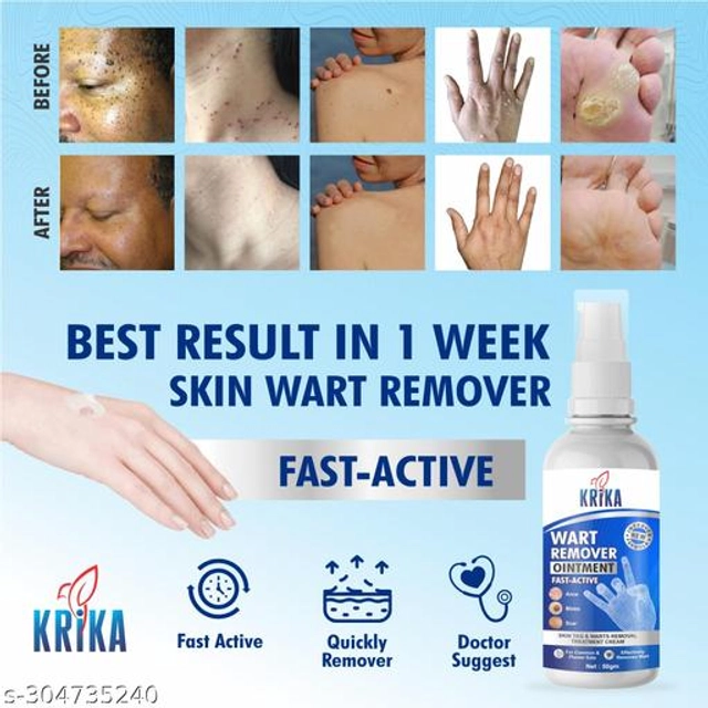 KRIKA Wart Remover Ointment (50 g)