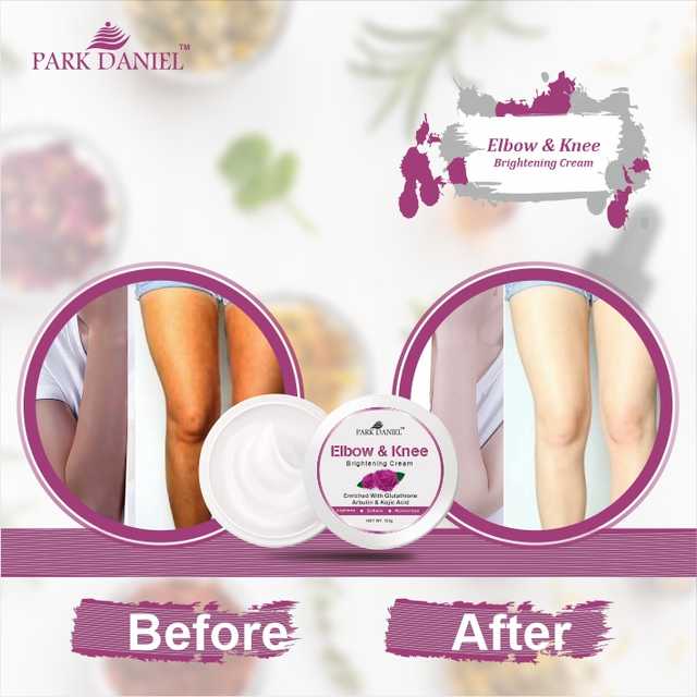 Park Daniel Elbow & Knee Brightening Cream (Pack of 4, 100 g) (SE-1877)