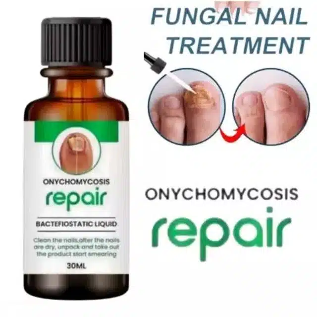 Fungal Nail Treatment (30 ml)