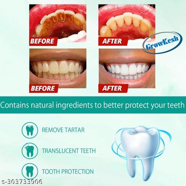 Growkesh Teeth Whitening Foam (60 ml)