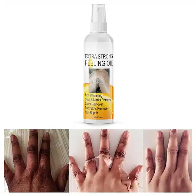 Newsio Skin Repair Extra Strong Peeling Oil (60 ml)