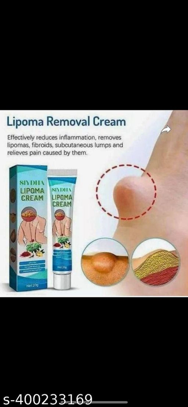 Lipoma Removal Cream (30 g)