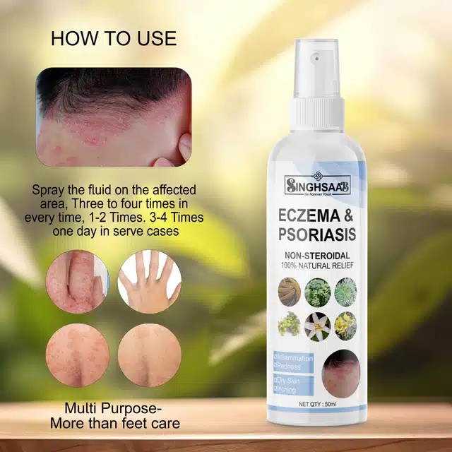 SinghSaab Eczema & Psoriasis Relief Spray (50 ml)