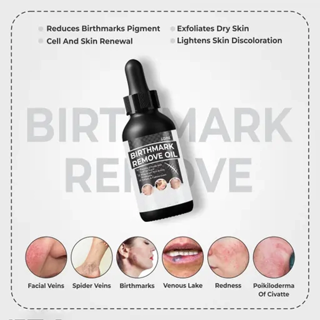 Natural Birth Marks and Blemish Removal Oil (50 g)