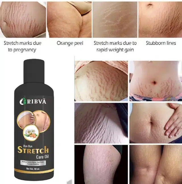 Ribva Stretch Marks Removal Oil, Reduce Scar (50 ml)