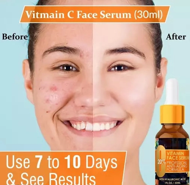 Vitamin C Face Serum (30 ml)