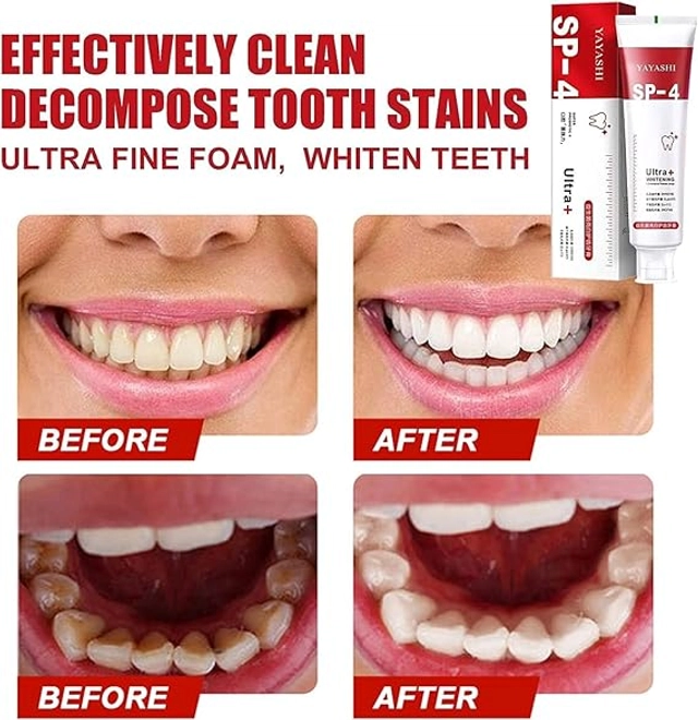 SP4 Teeth Treatment Toothpaste (30 g)