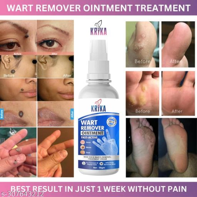 KRIKA Wart Remover Ointment (50 g)