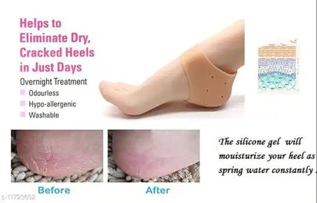 Silicone Pain Relief Heel Socks for Unisex (Beige)