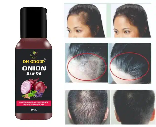 Dh Group Red Onion Hair Oil For Help To Hair Growth And Hair Loss Control (60 ml)