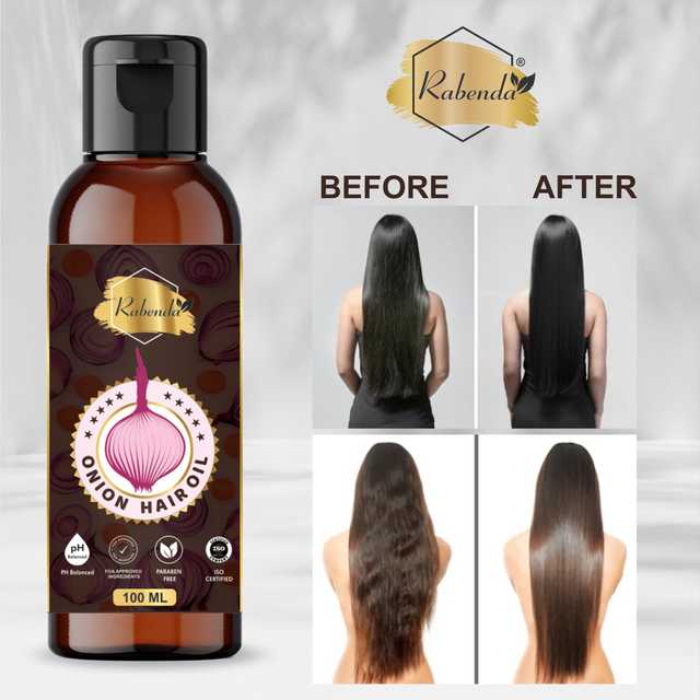 Rabenda Onion Hair Oil With 14 Essential Oils For Hair Regrowth, Dandruff Control Hair Oil (100 ml, Pack of 2) (O-18)