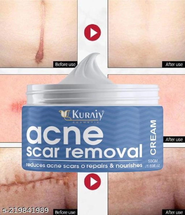 KURAIY Acne Scar Removal Cream (50 g)