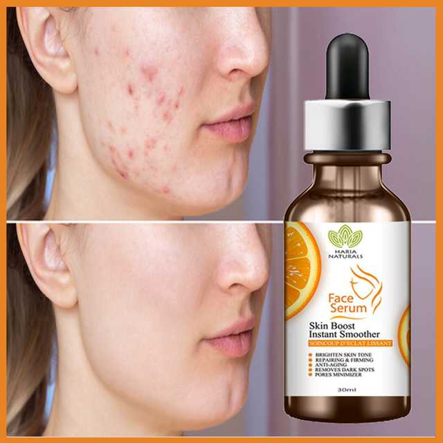 Haria Naturals Vitamin C Professional Anti-Aging & Wrinkle Reducer-Skin Clearing Face Serum-Brightens Skin Tone, Reduces Wrinkes, Fine Line & Repairs Sun Damage (30 ml) (B-14682)