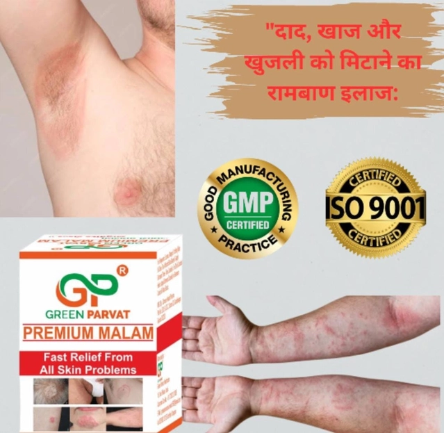 Green Parvat premium malam Anti fungal cream 20 gm