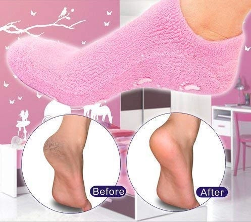 Moisturizing Gel Socks (Assorted, Set of 1)