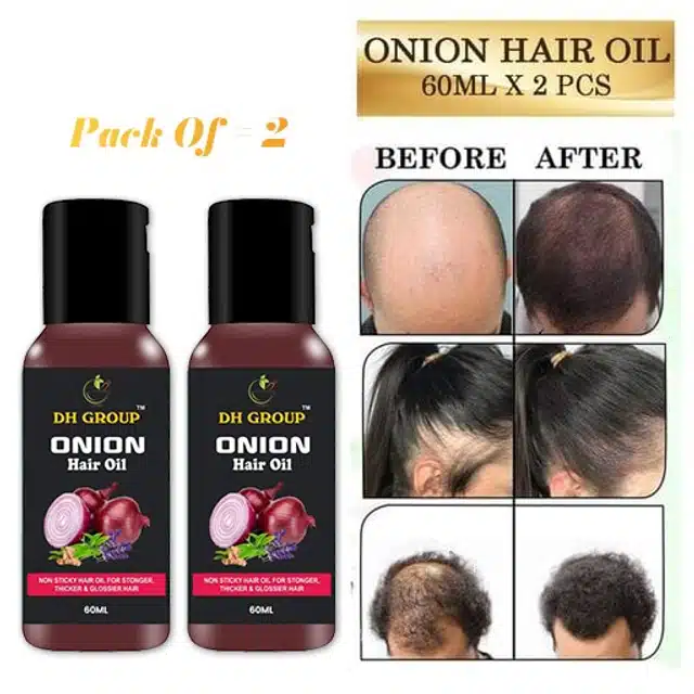 Red Onion Hair Oil for Hair Growth (Pack of 2, 60 ml)