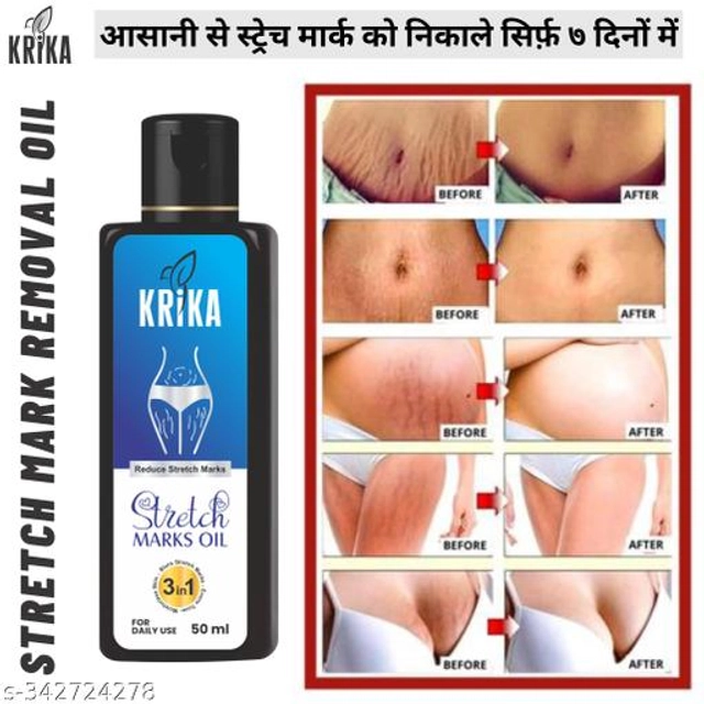 Krika Stretch Marks Removal Oil (50 ml)