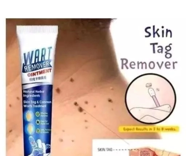 Wart Remover Cream (100 g, Pack of 3)