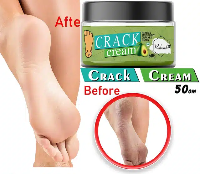 Foot Crack Cream (50 g) (KF-15)