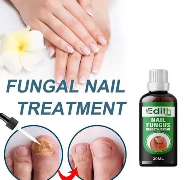 Nail Fungus Treatment Oil (30 ml)