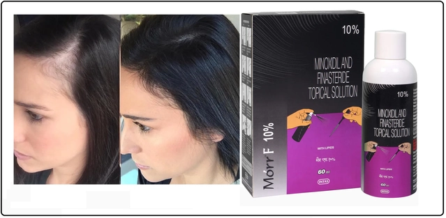 Minoxidiland & Finasteride Topical Solution for Hair Growth (60 ml)