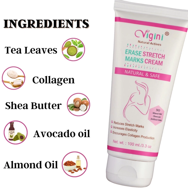 Vigini Erase Stretch Marks Cream (100 g)