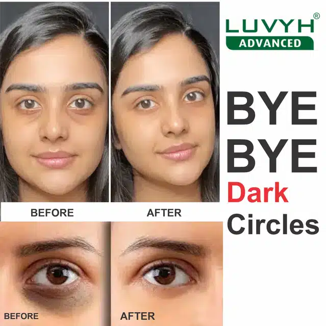 Dark Circles Eye Cream (100 g)