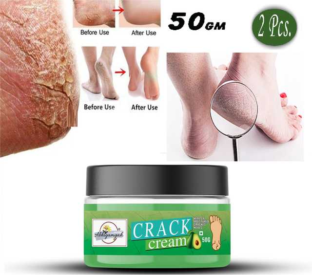 Foot Care Cream For Rough, Dry And Cracked Heel For Healing & Softening (50 g) (Ab-00486)
