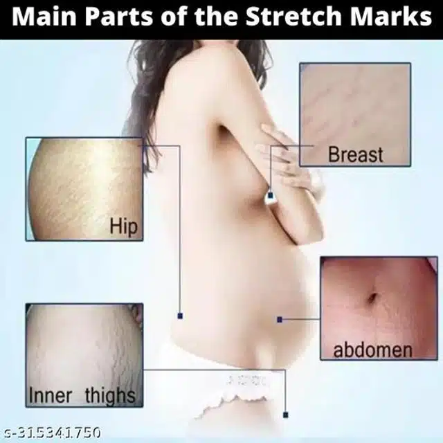 Phillauri Stretch Marks Creams for Men & Women (100 ml)